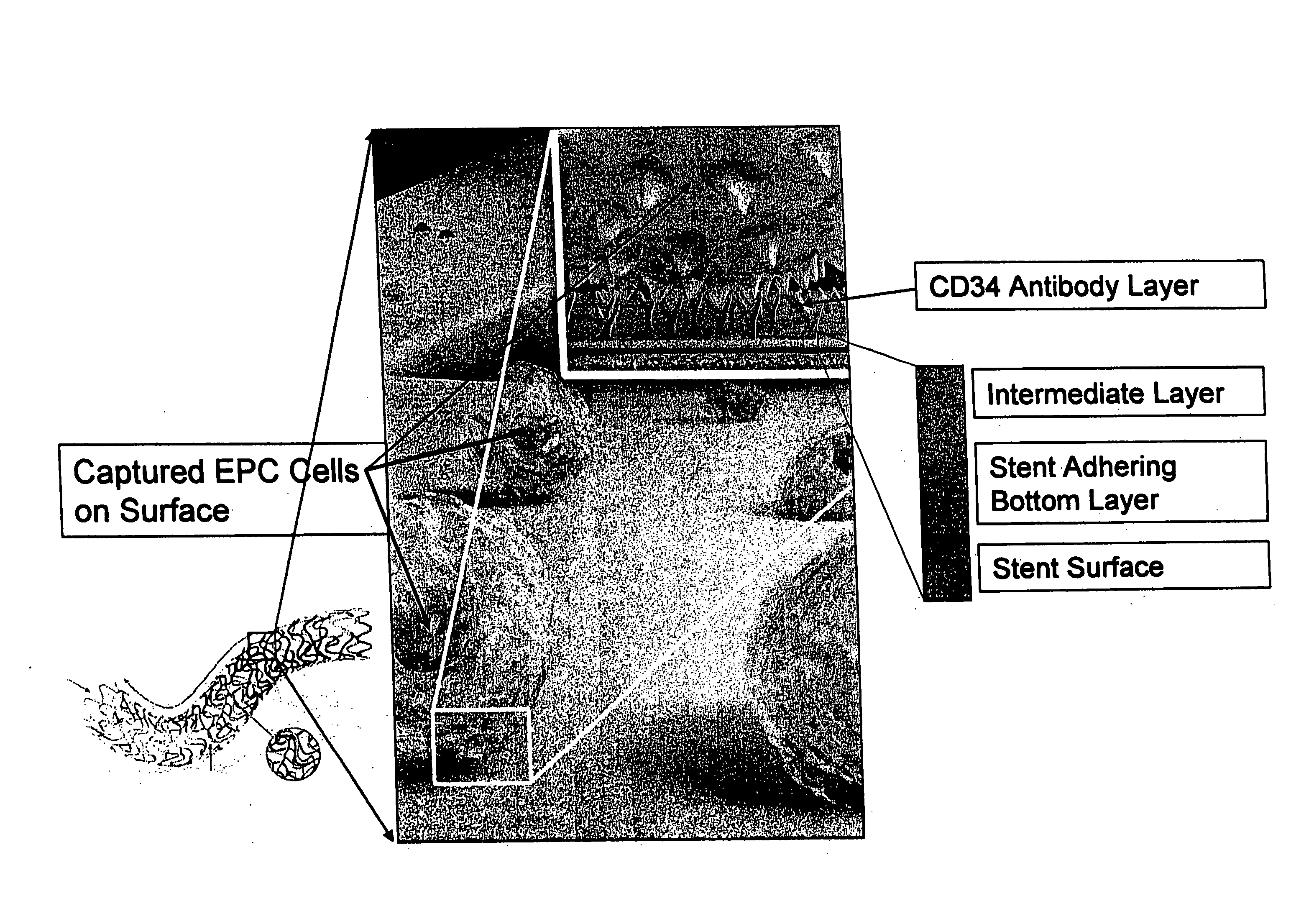 Medical device with coating for capturing genetically-altered cells and methods of using same