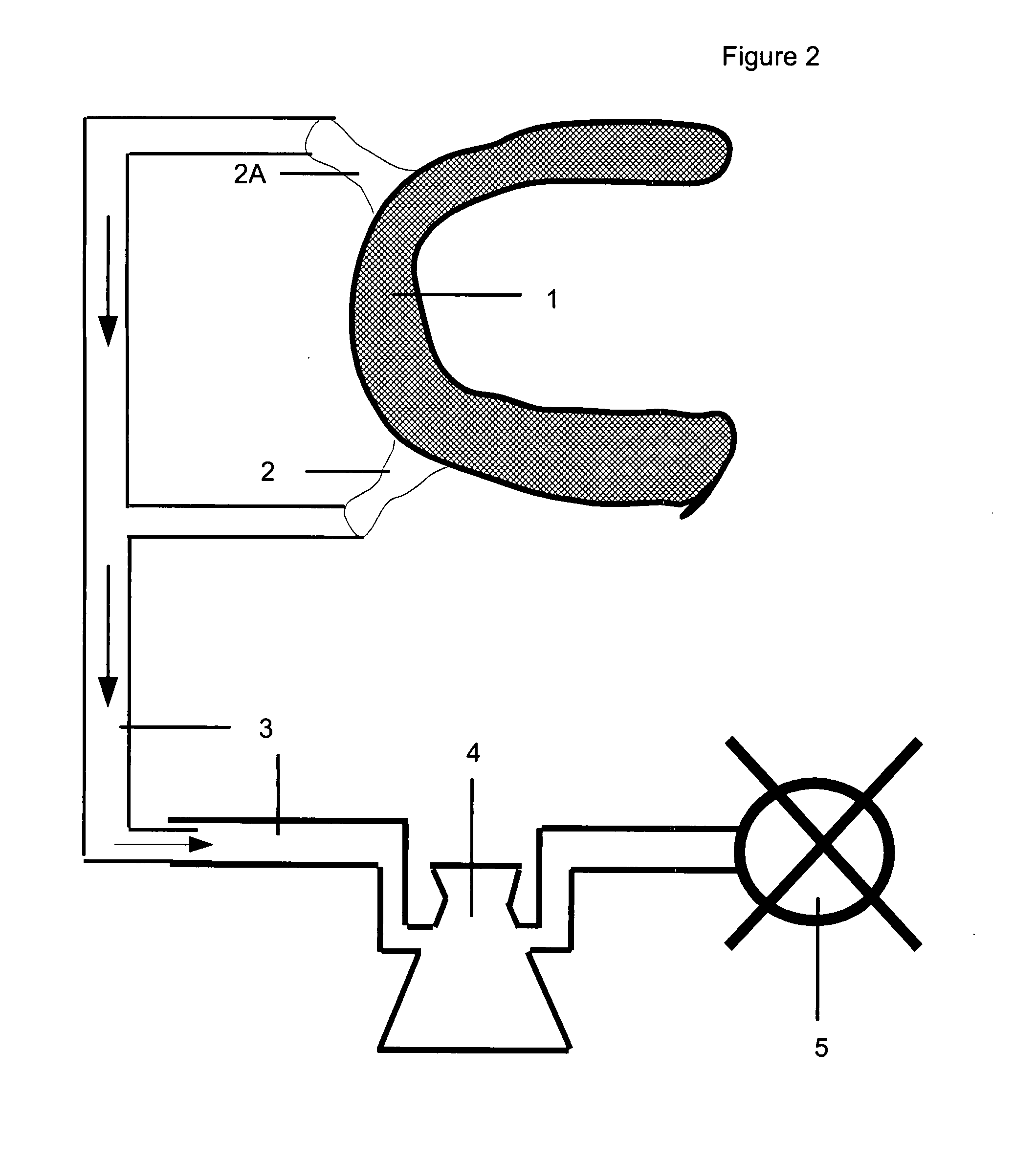 Use of vacuum suction in conjunction with diapers.