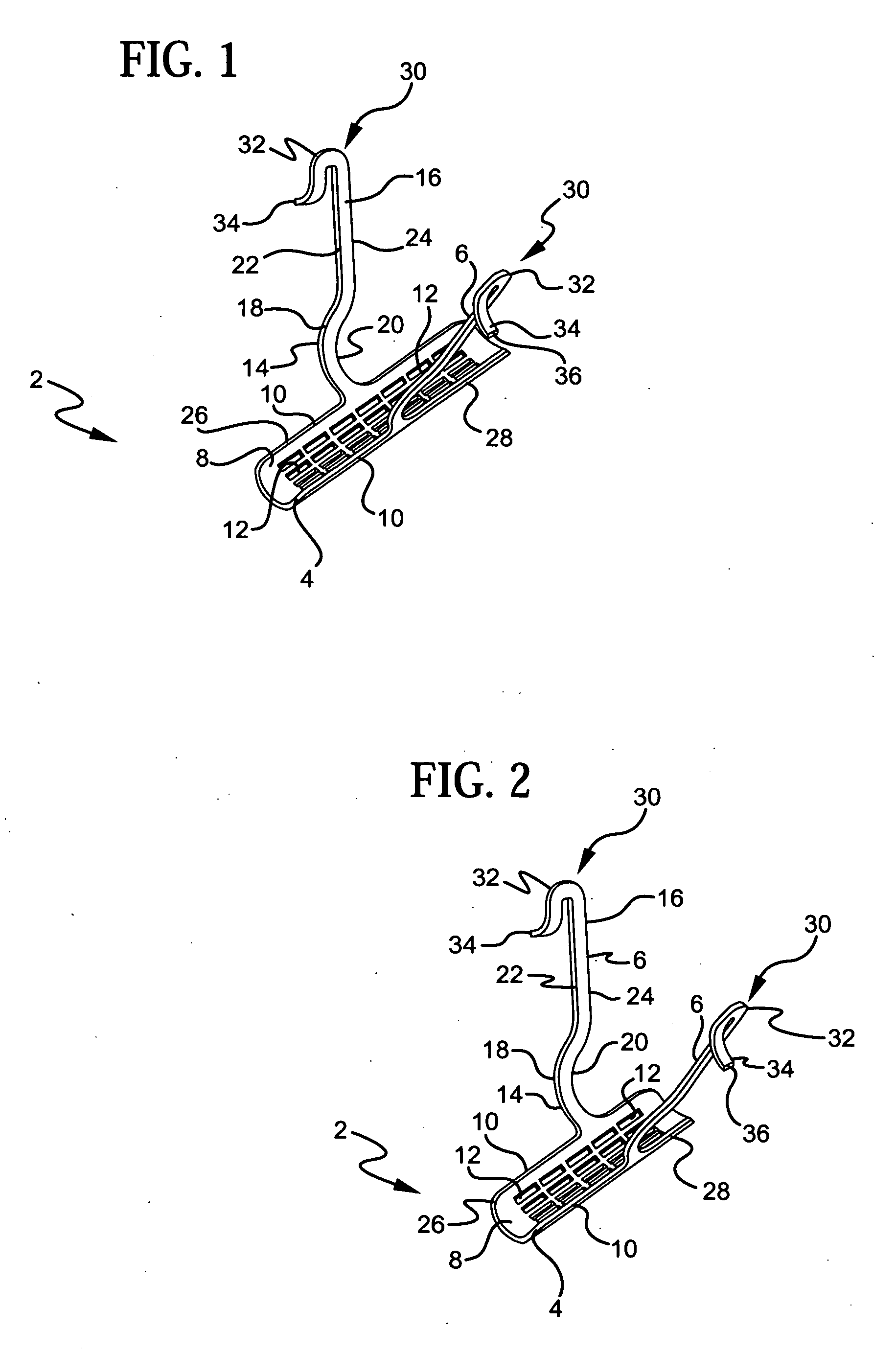 Stress urinary incontinence implant and device for deploying same