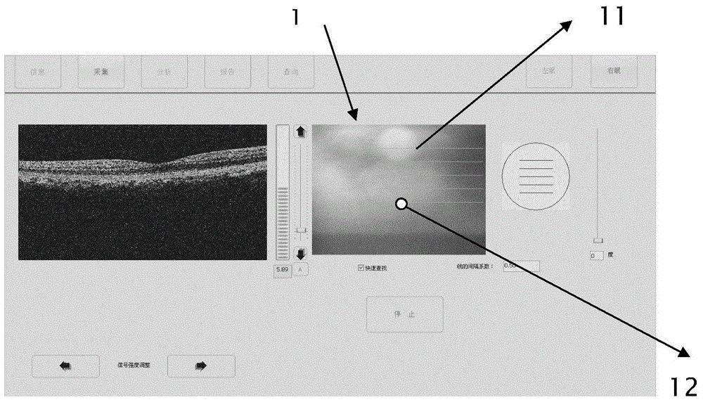 Method for detecting deviation of retina fixation point relative to macular central fovea