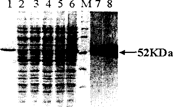 Human papilloma virus and heat shock protein recombinant protein vaccine and use thereof