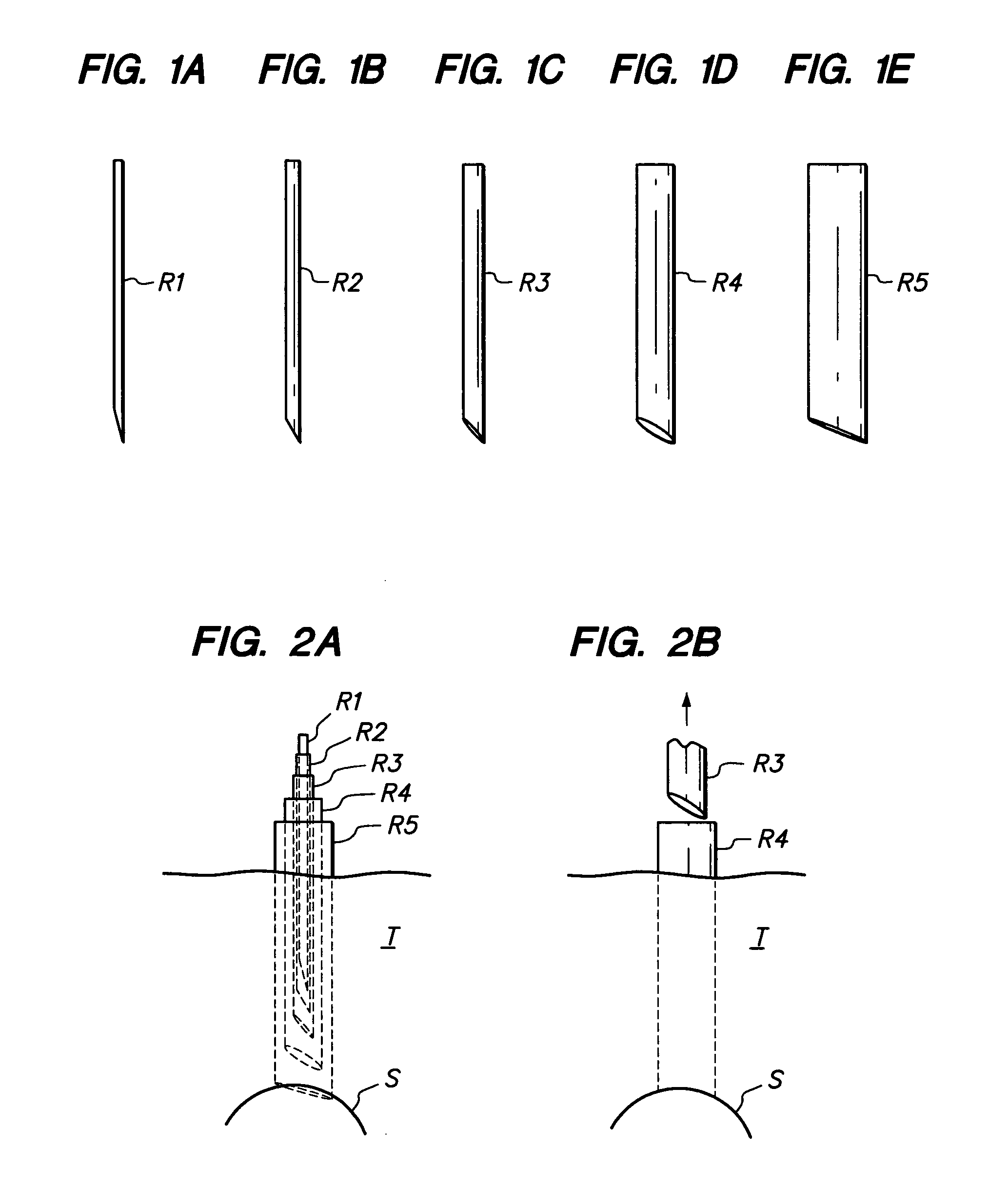 Method and apparatus for minimally invasive spine surgery