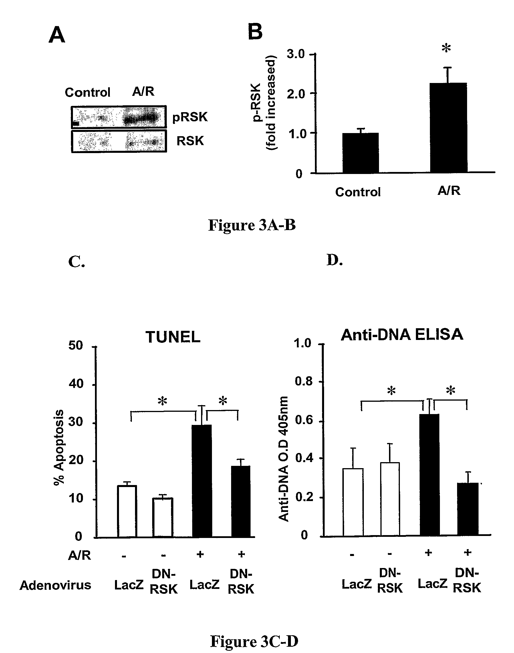 Transgenic Non-Human Animal Models of Ischemia-Reperfusion Injury and Uses Thereof