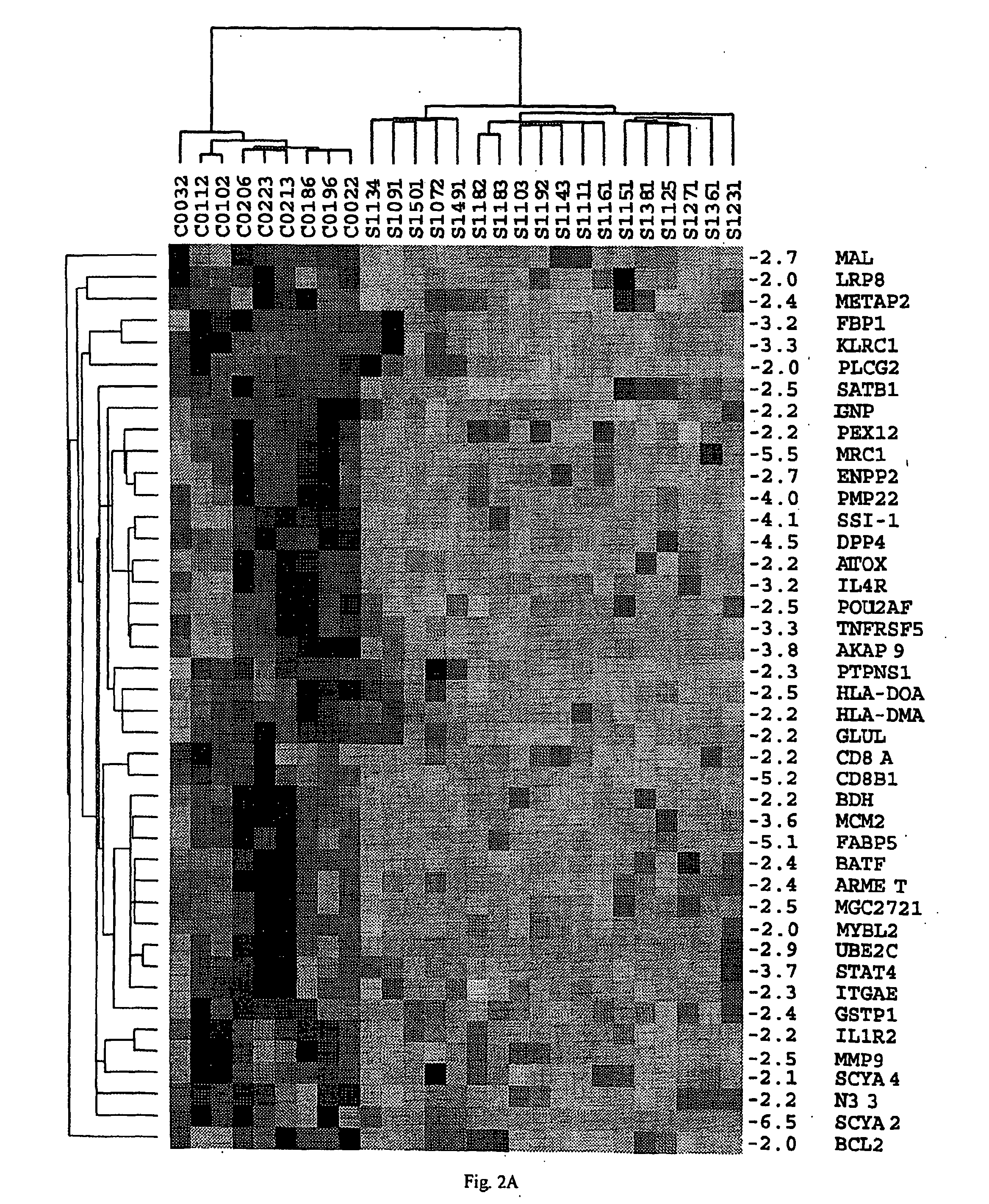 Method of diagnosis of cancer based on gene expression profiles in cells