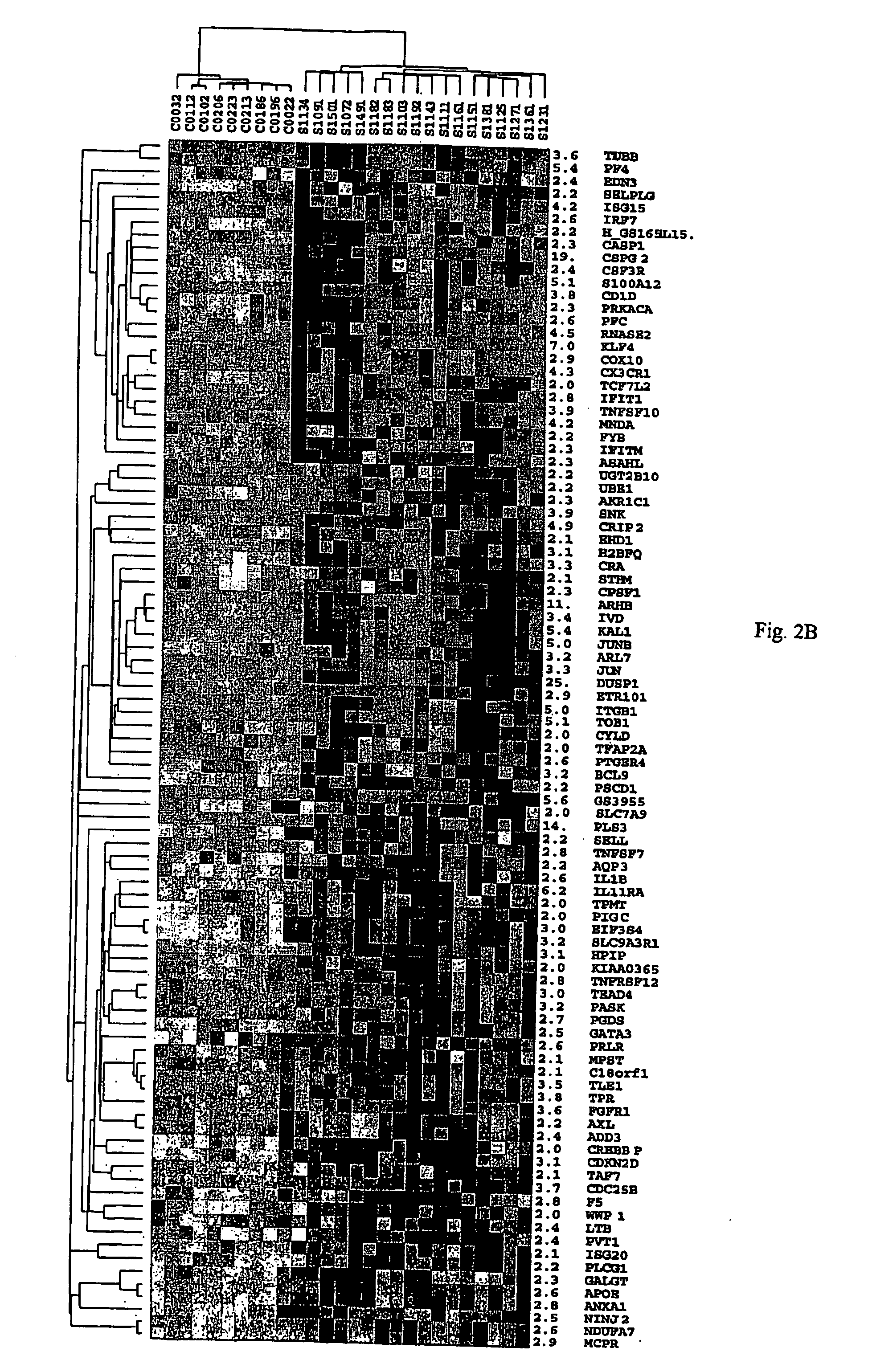 Method of diagnosis of cancer based on gene expression profiles in cells
