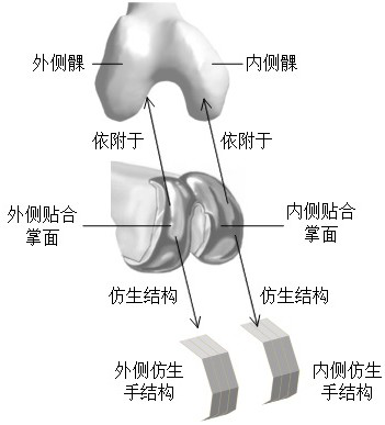 Femoral condyle prosthesis fitting surface design method based on bionic hand structure and application