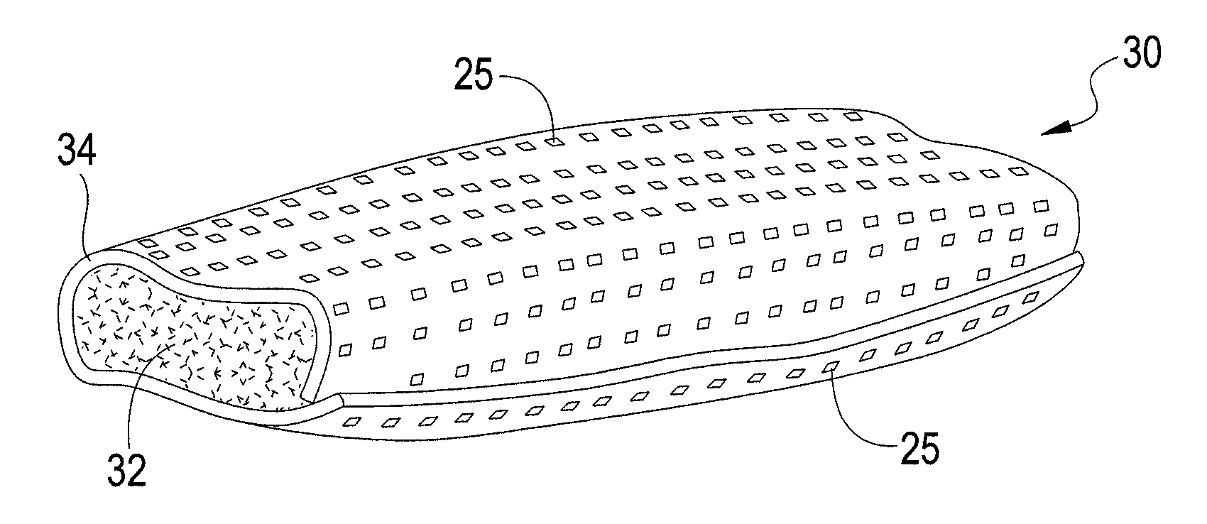 Osteoconductive implants and methods of using same