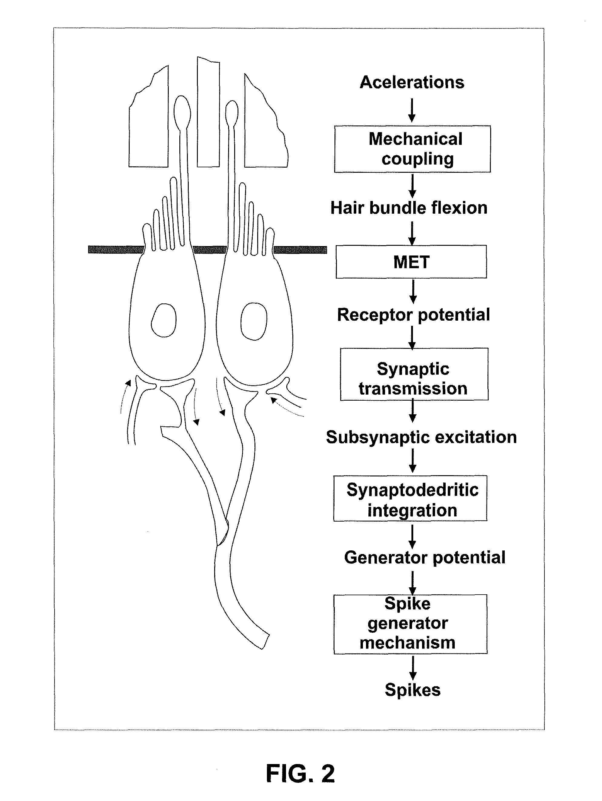 Vestibular prosthesis