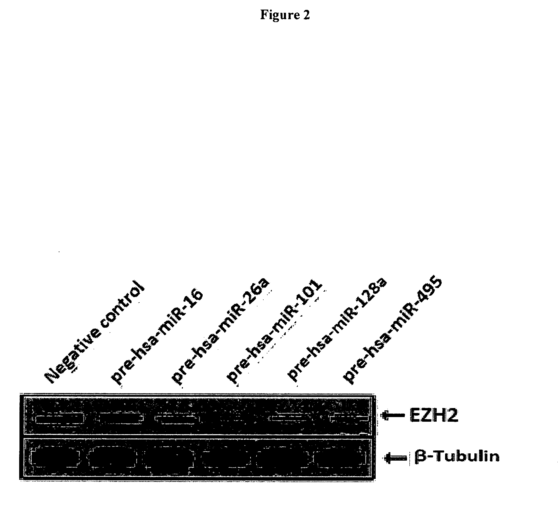 EZH2 Cancer Markers