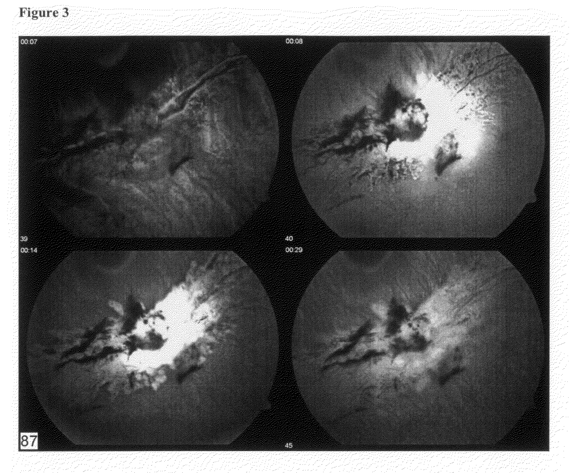 Compositions and methods for treating ophthalmic disorders