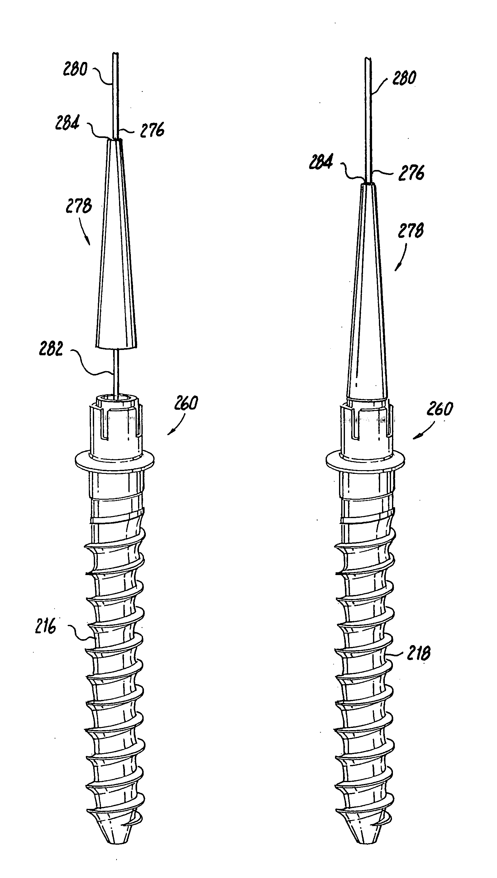 Mounting mechanisms for pedicle screws and related assemblies