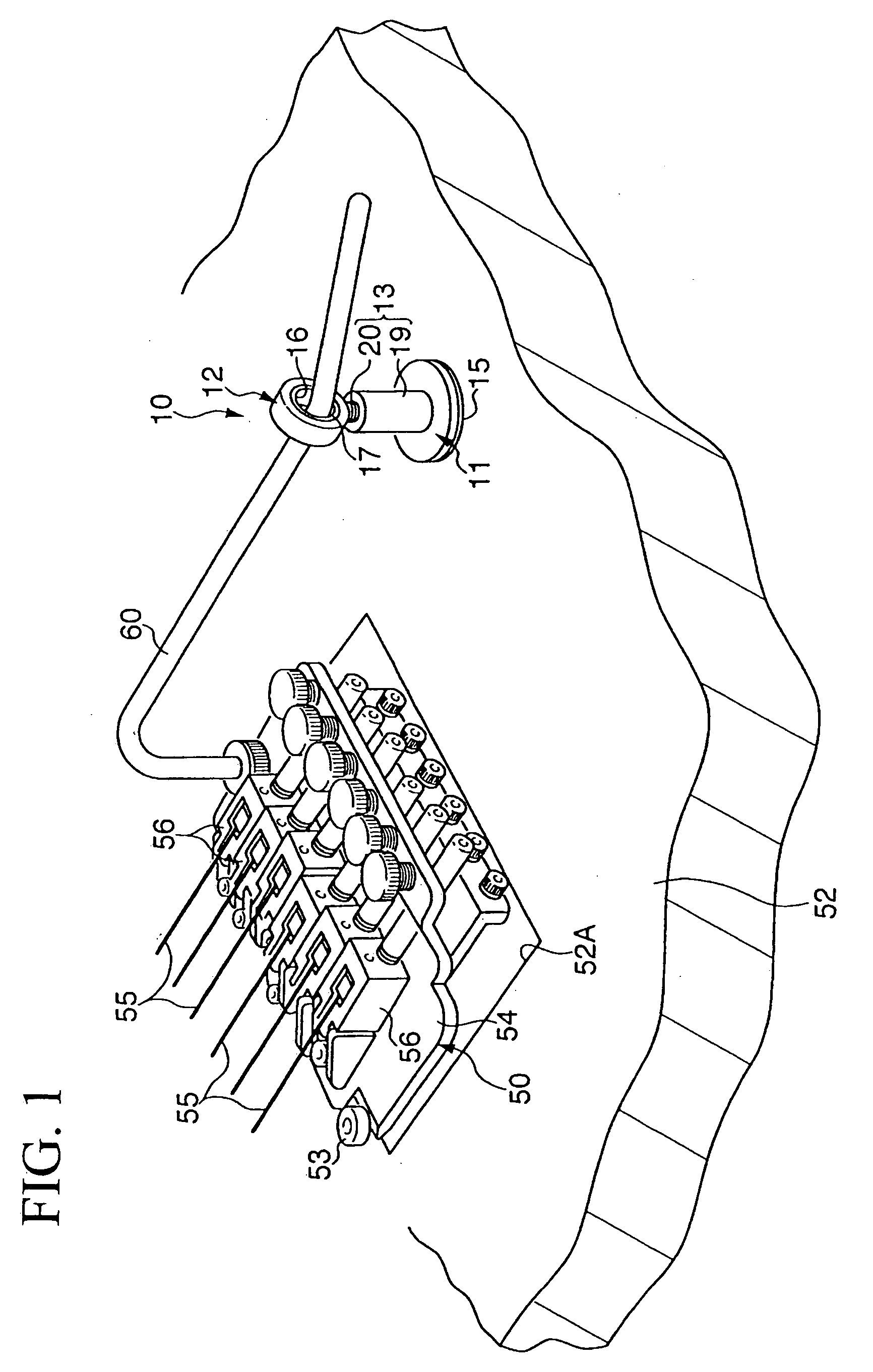 String replacement assistance apparatus