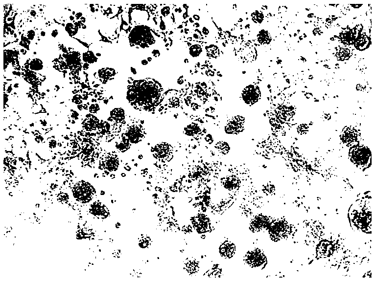 Duck reovirus causing duck spleen necrosis as well as inactivated vaccine and application thereof