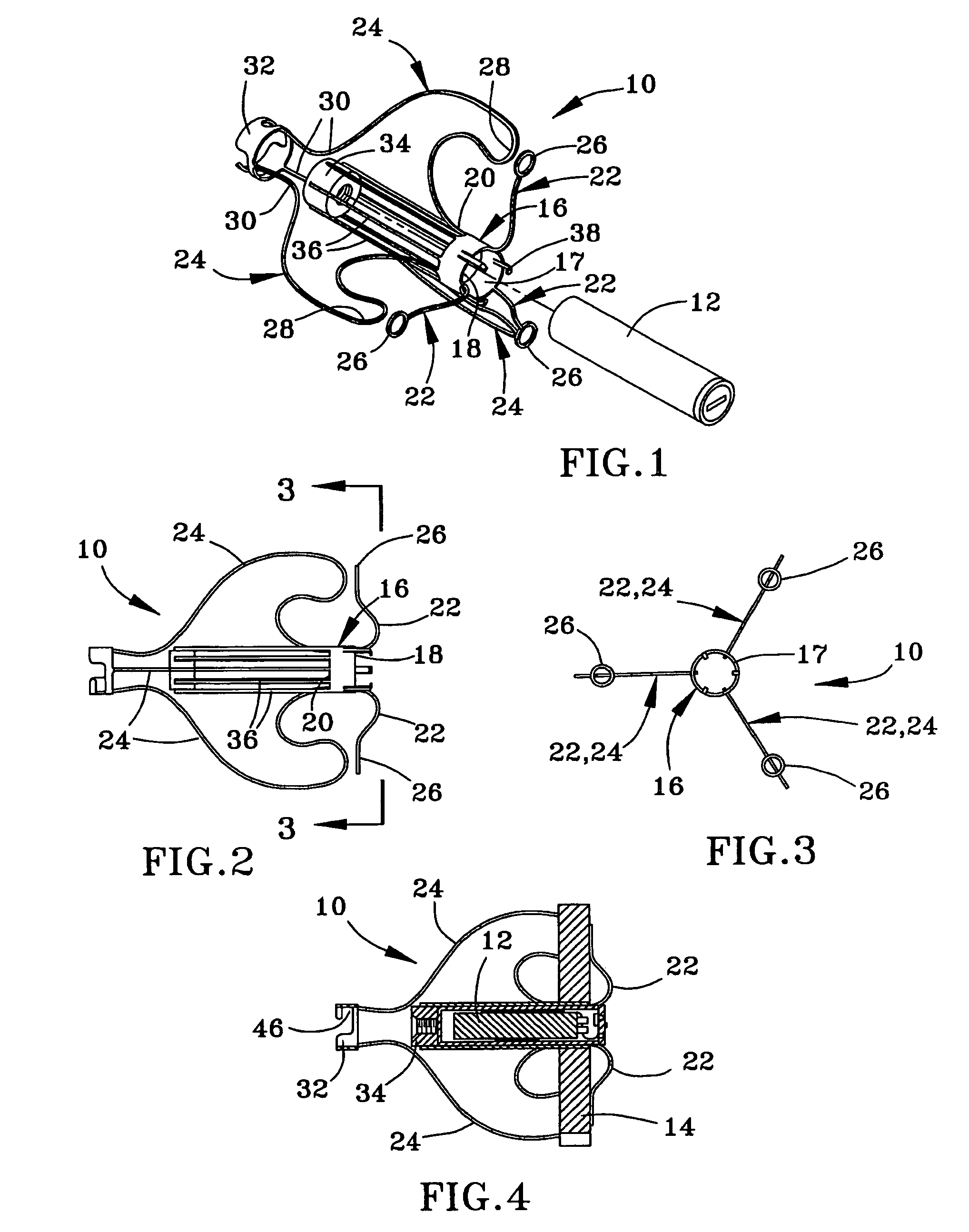Anchor for medical implant placement and method of manufacture