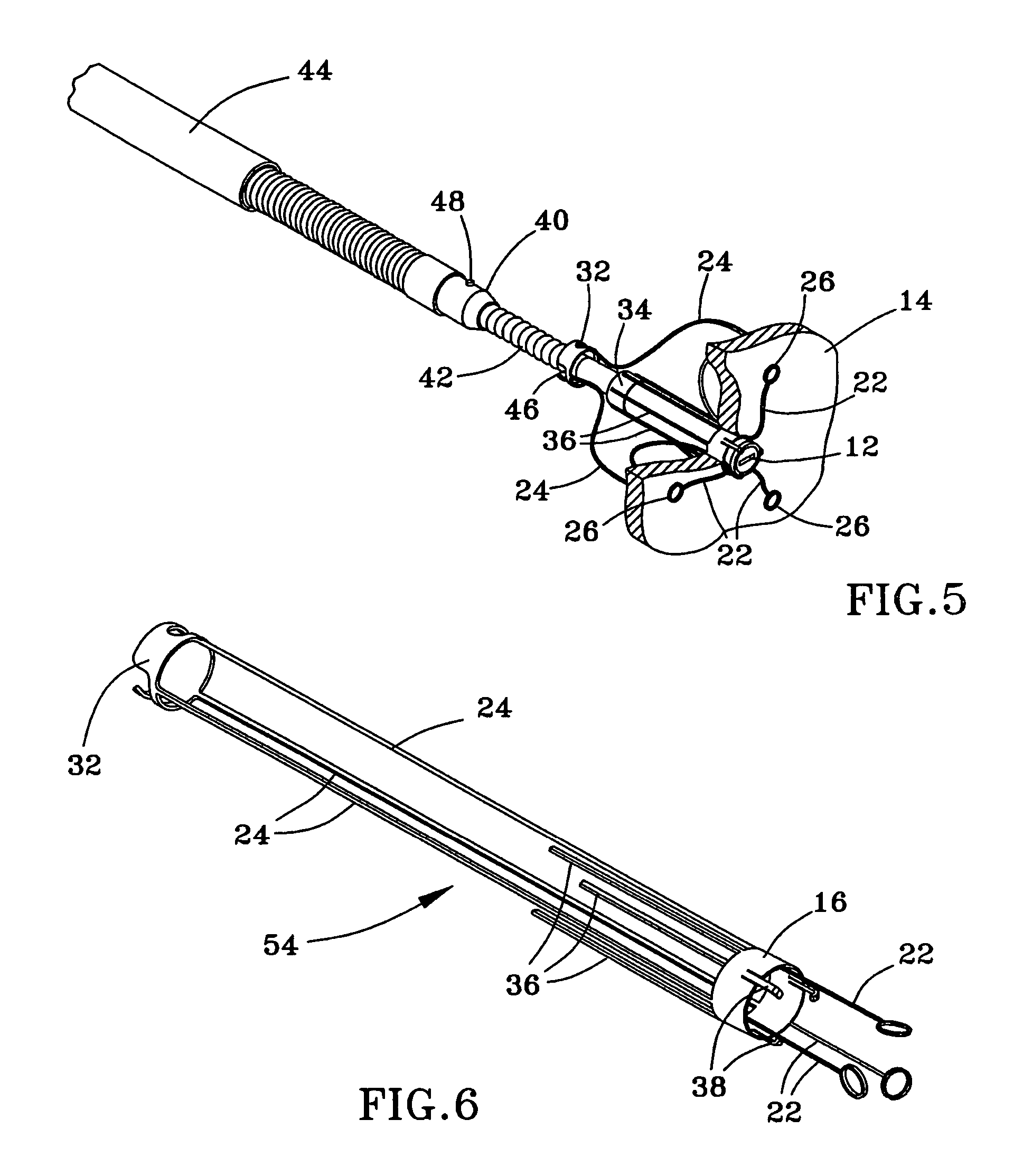 Anchor for medical implant placement and method of manufacture