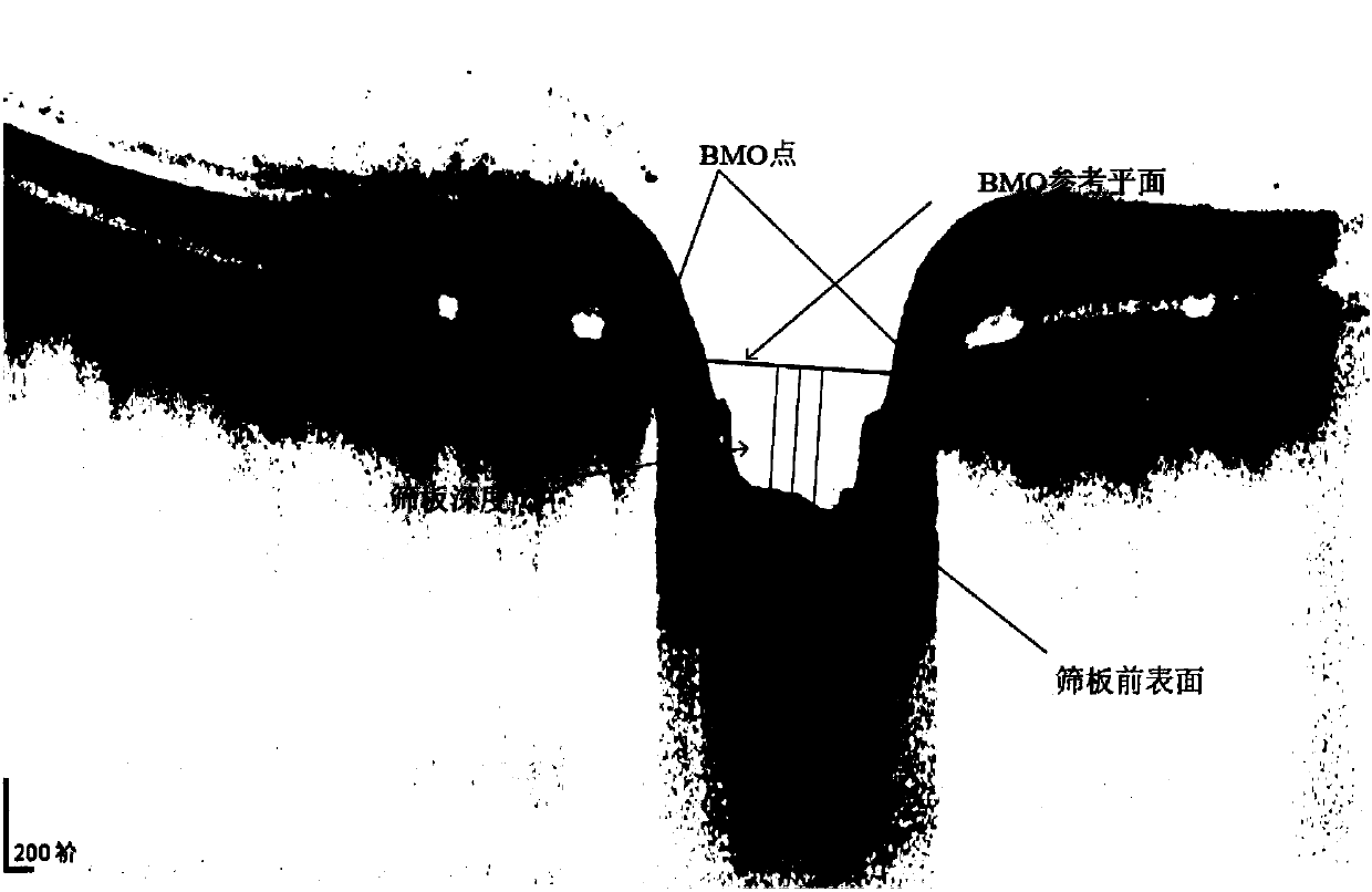 Method for measuring depth of front surface of lamina cribrosa based on active contour and energy constraint