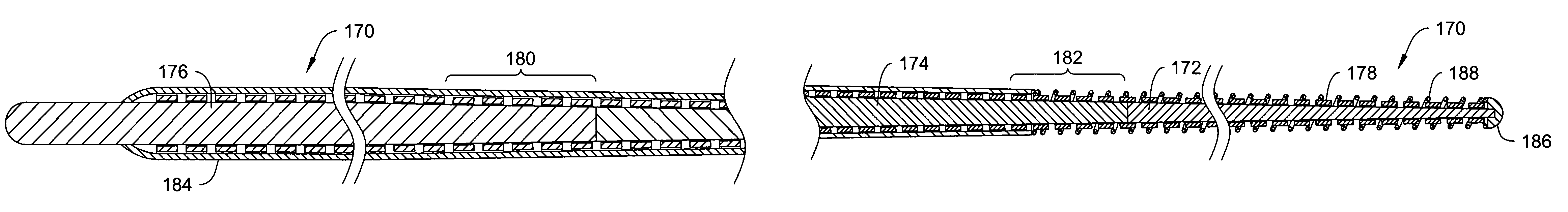 Composite braided guidewire