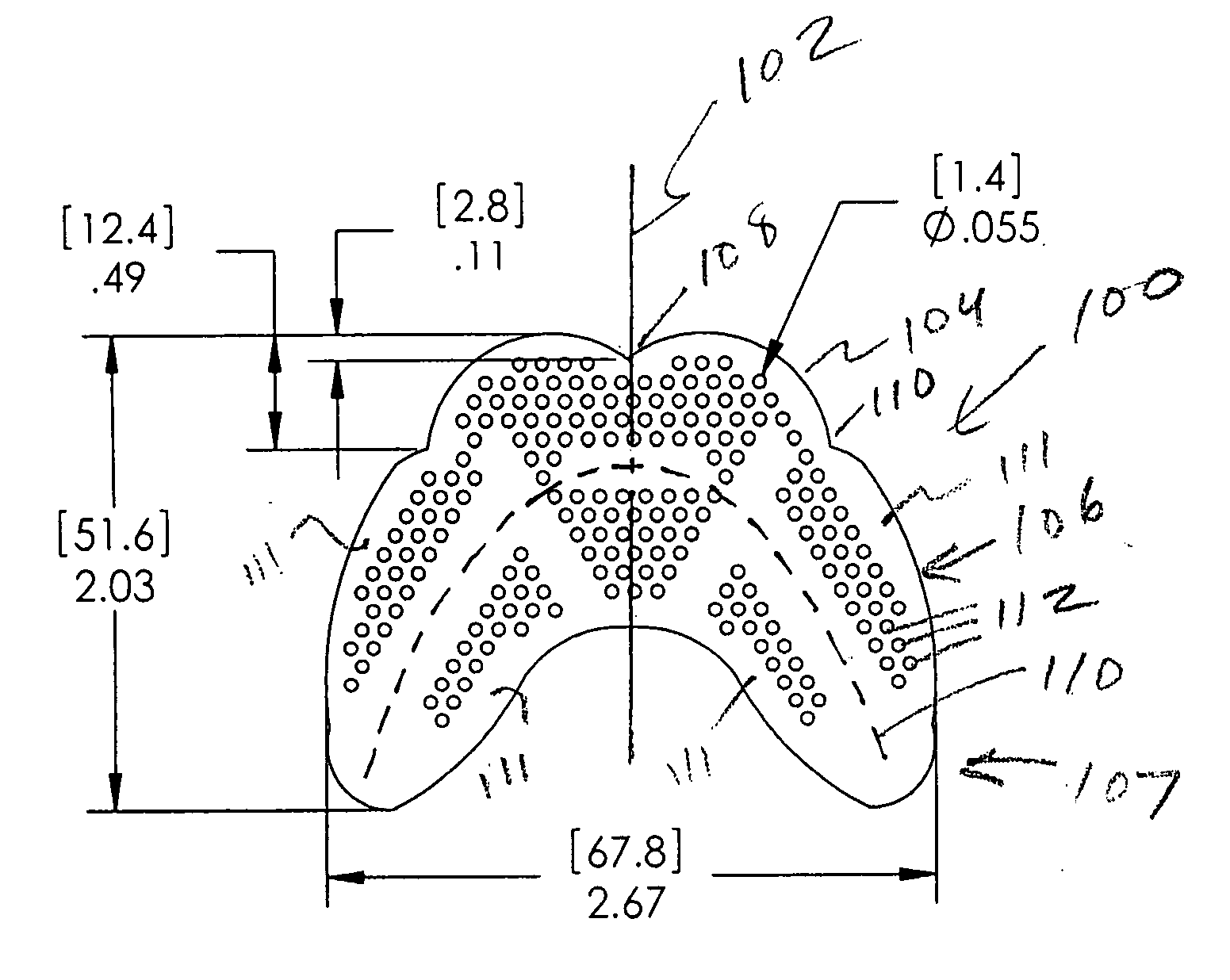 Custom-formable mouth guard and method of fabrication