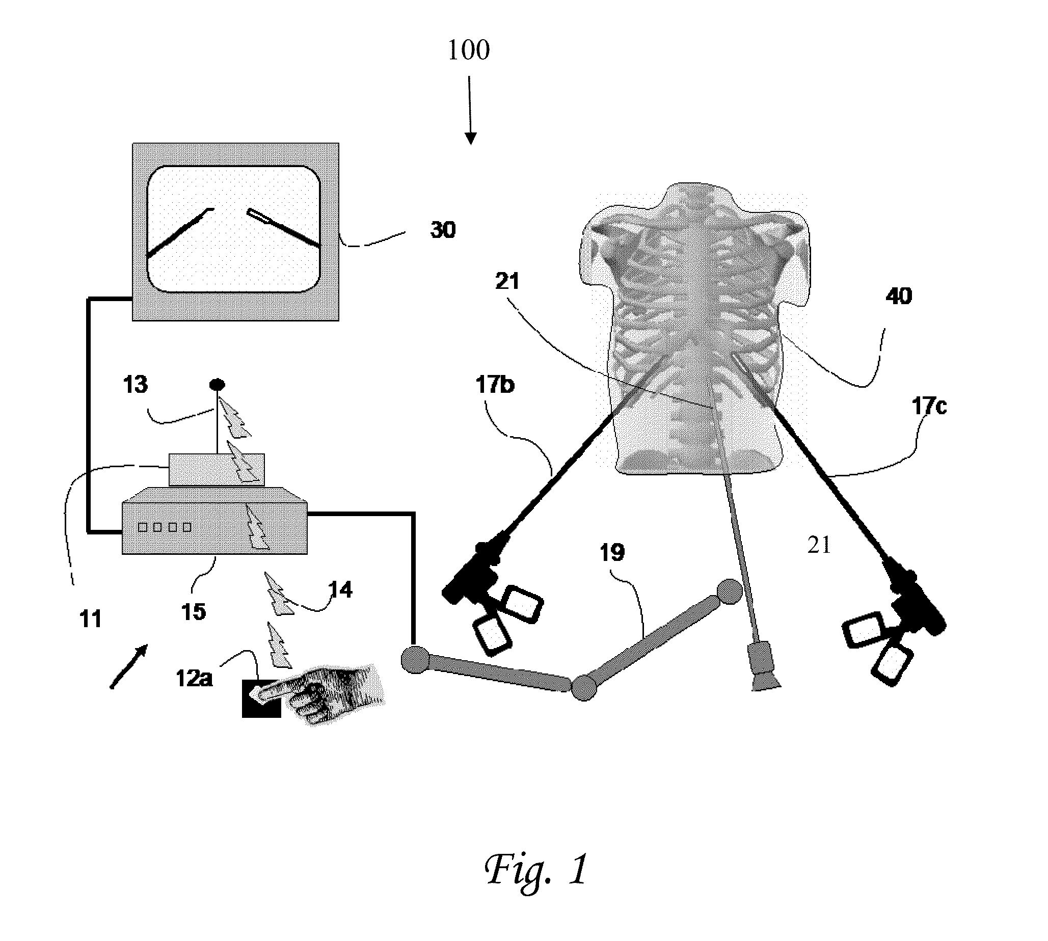 Device and method for asissting laparoscopic surgery rule based approach