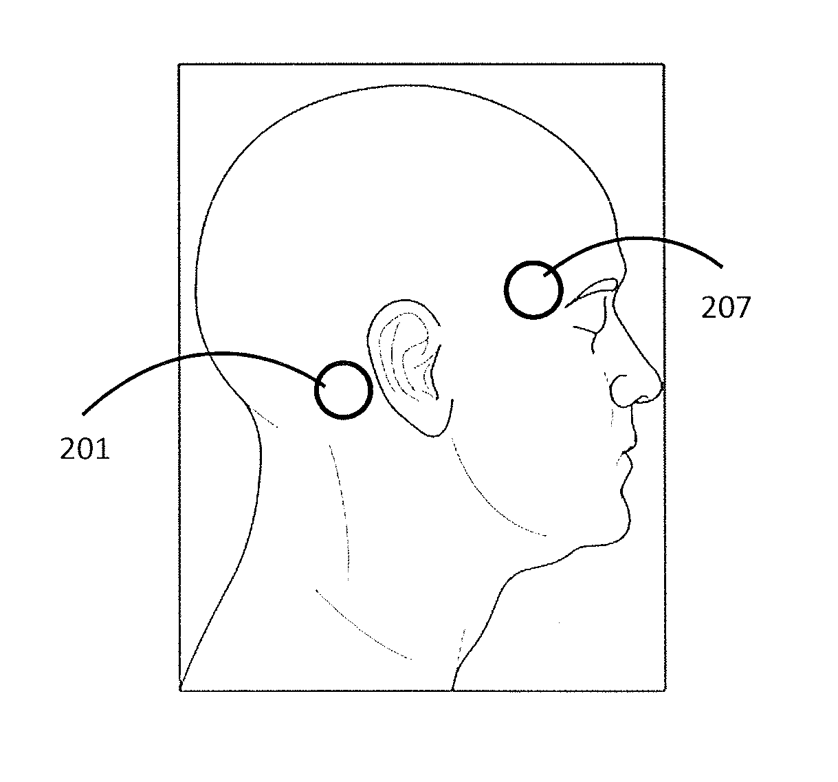 Apparatuses and methods for transdermal electrical stimulation of nerves to modify or induce a cognitive state