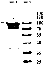 Kit for detecting chicken Marek's disease virus antibody and application thereof