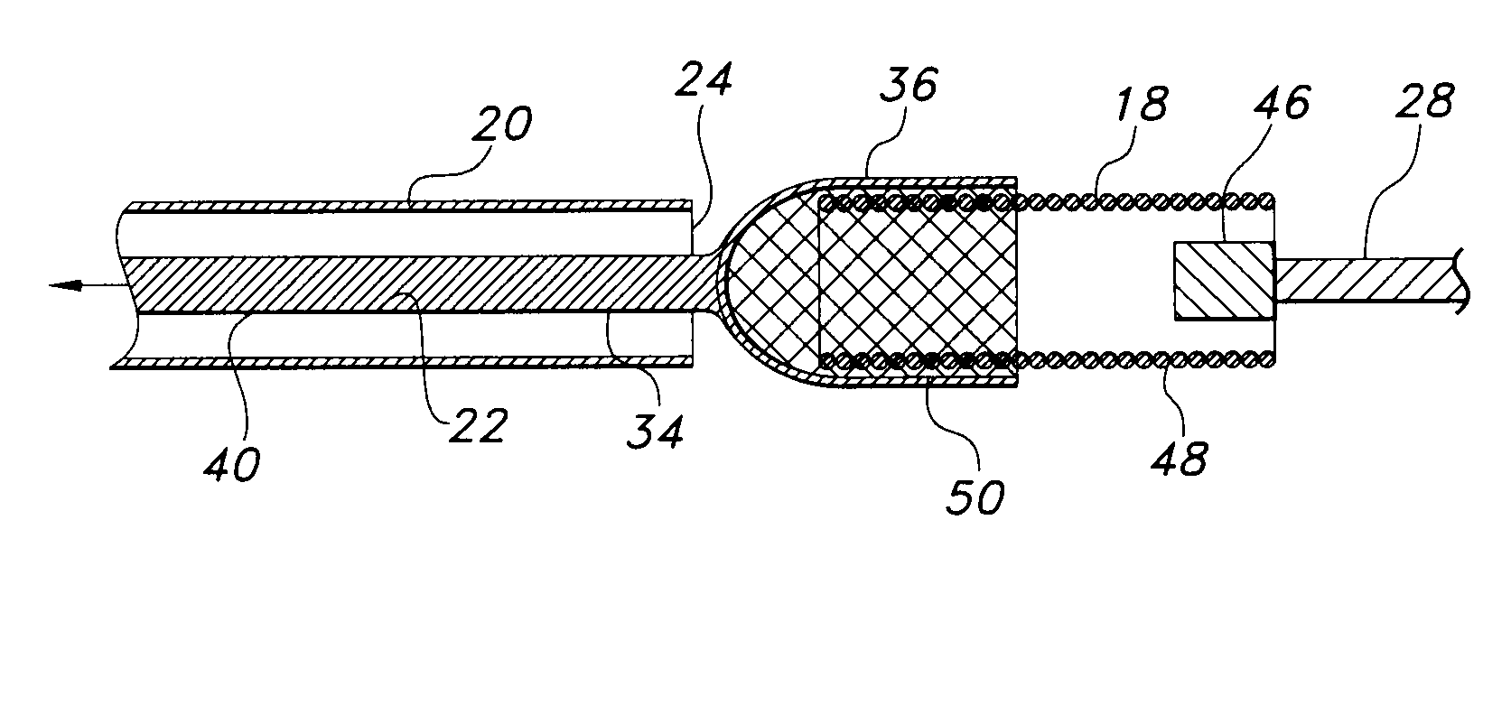 Prosthesis loading delivery and deployment apparatus