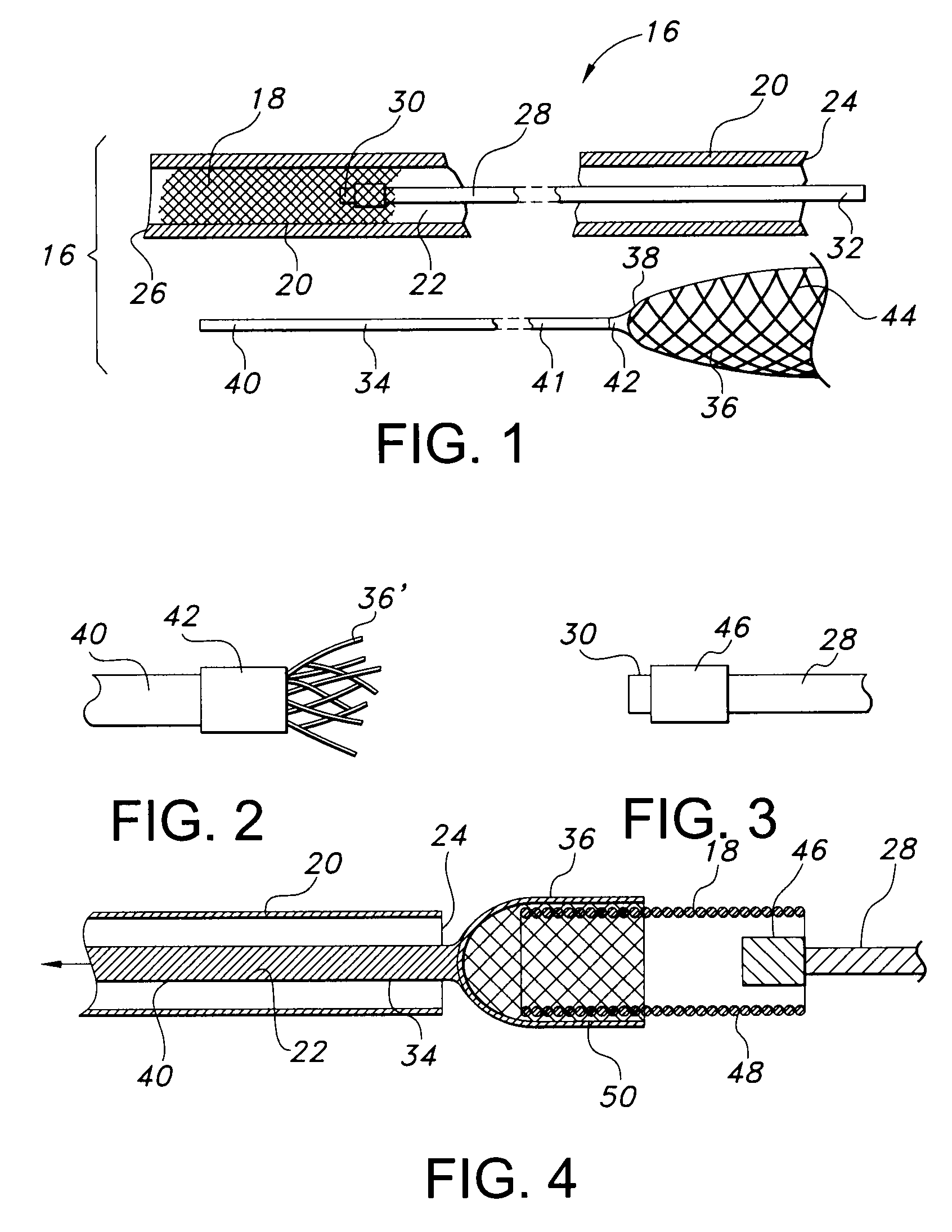 Prosthesis loading delivery and deployment apparatus