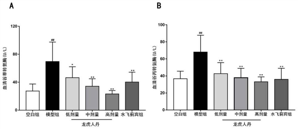 Novel application of rendan mini-pill traditional Chinese medicine composition in alleviation of hangover or treatment of alcoholic liver injury