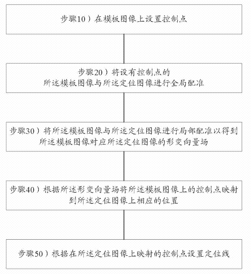 Method and device for setting positioning line on positioning image and CT equipment