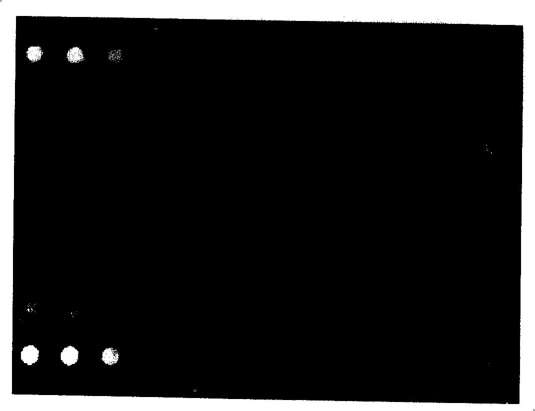 Gene chips for detecting of pathogens of sexually transmitted diseases and reagent kit for detecting