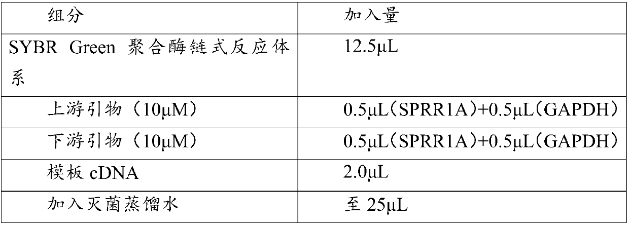 Application of sprr1a gene in preparation of osteoarthritis diagnostic products