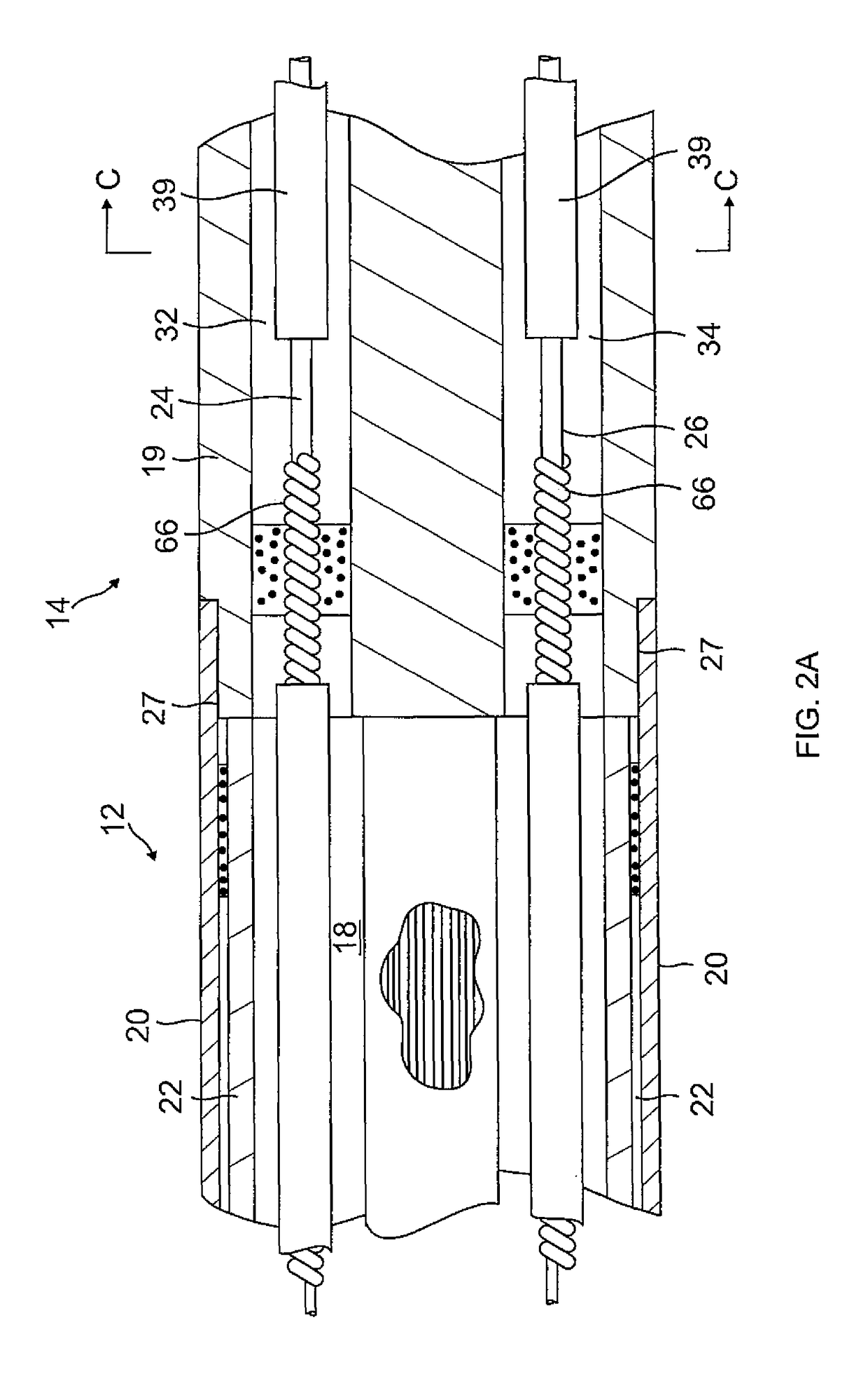 Catheter with high density electrode spine array
