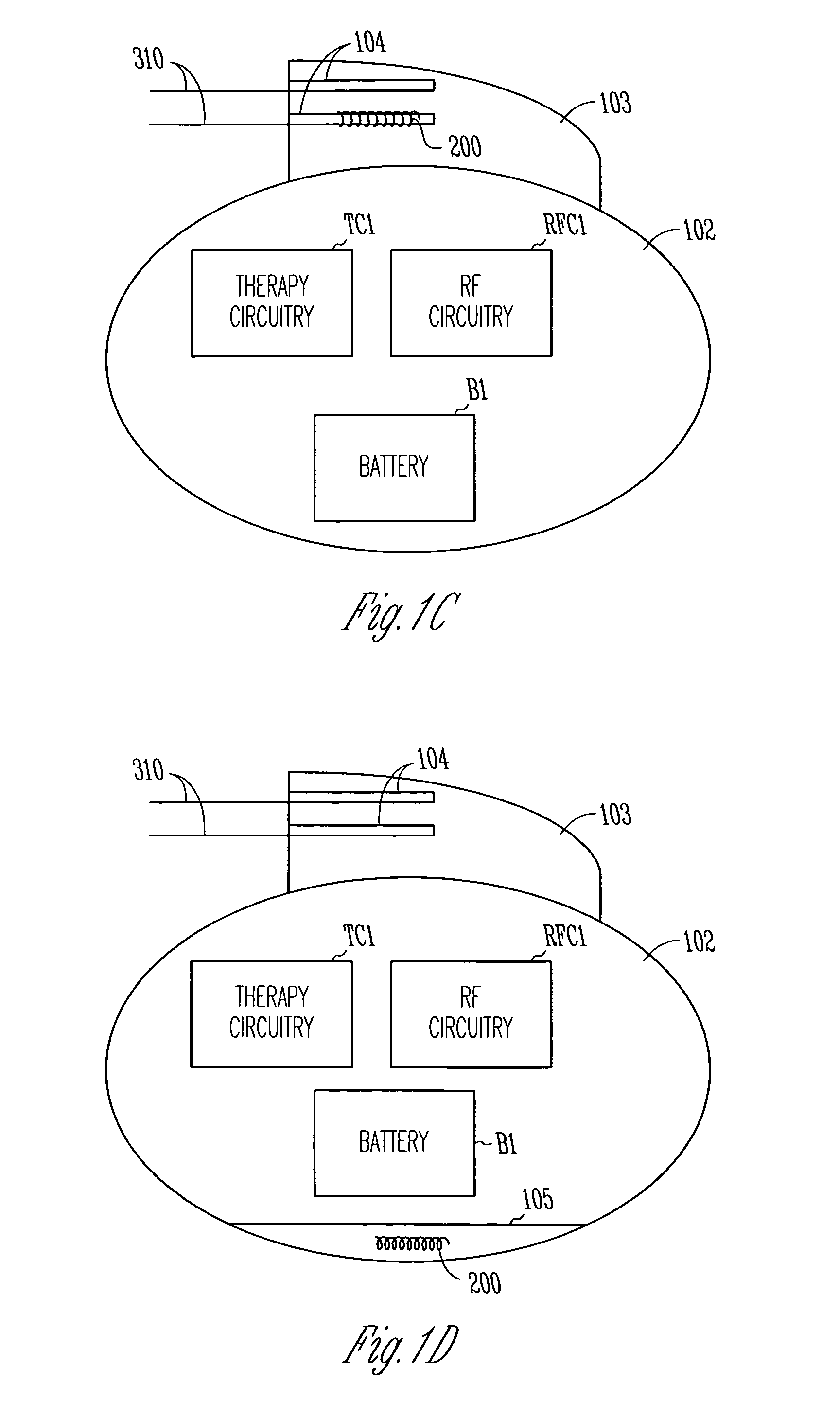 Antenna for an implantable medical device