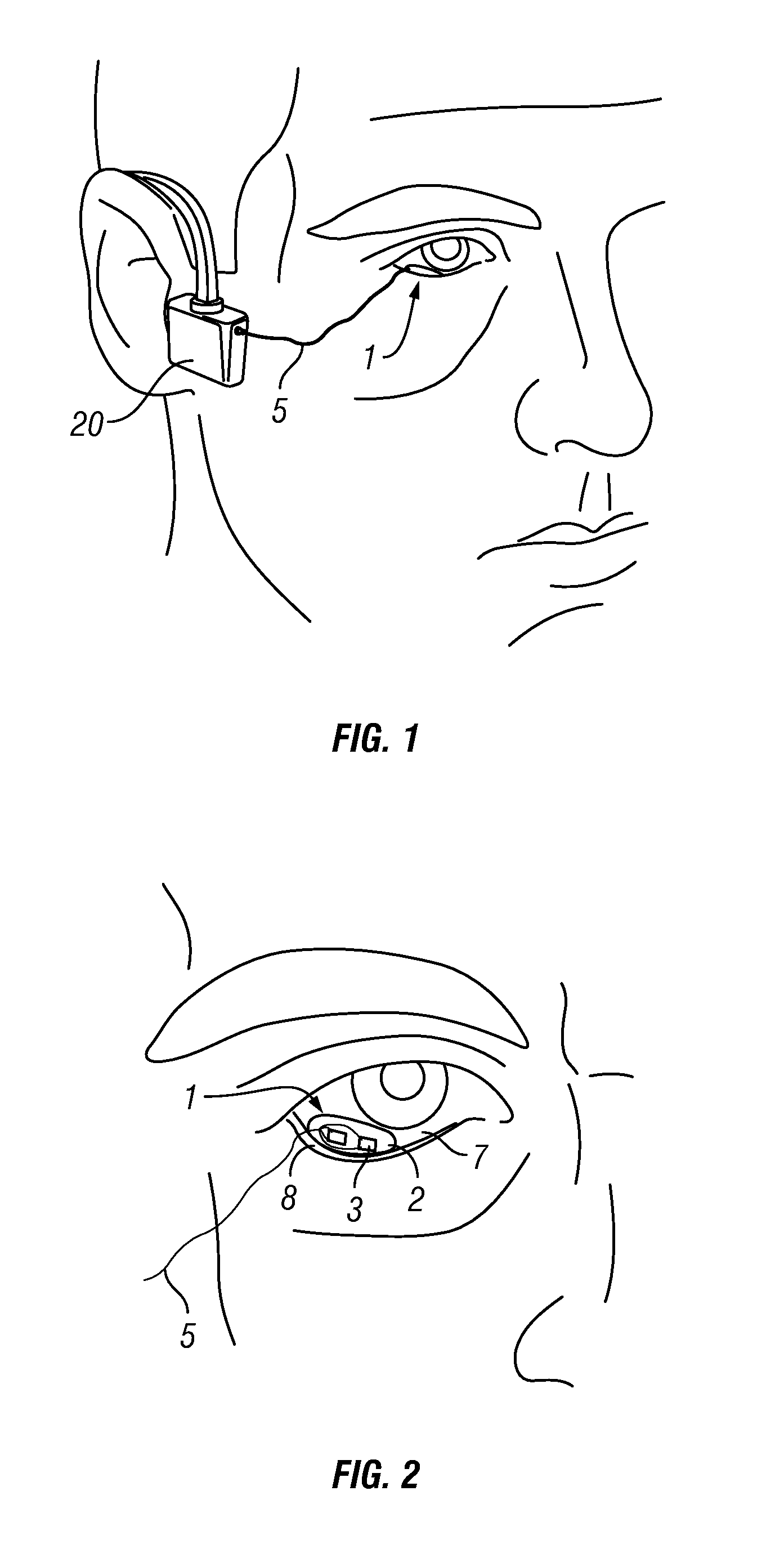 Photokinetic ocular drug delivery methods and apparatus