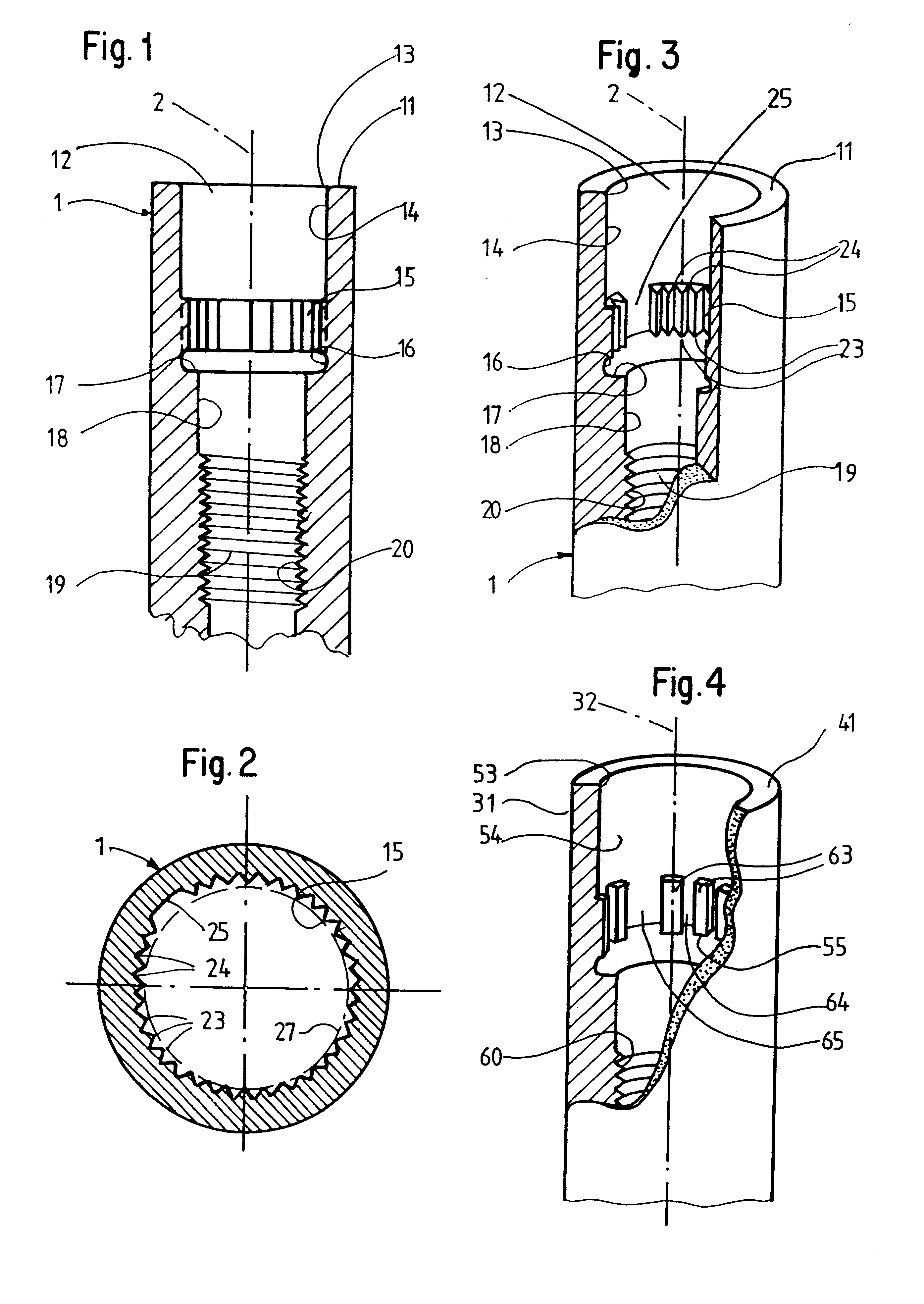Dental implant and device with a dental implant