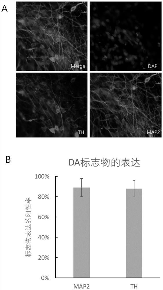 A method for preparing high-purity induced pluripotent stem cell-derived human brain dopaminergic neurons