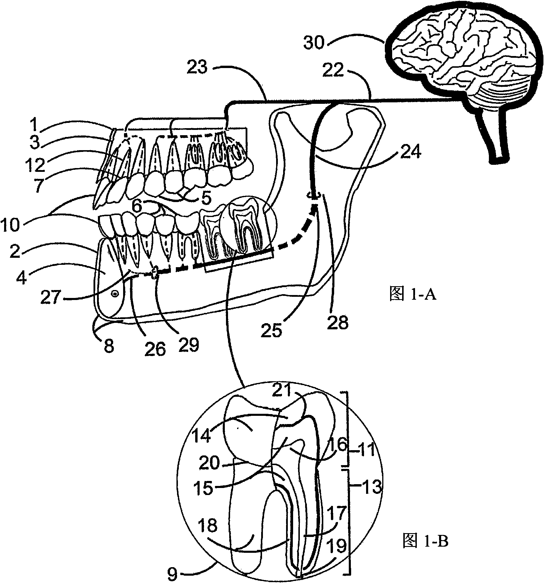 A method and a device for practicing dental treatments