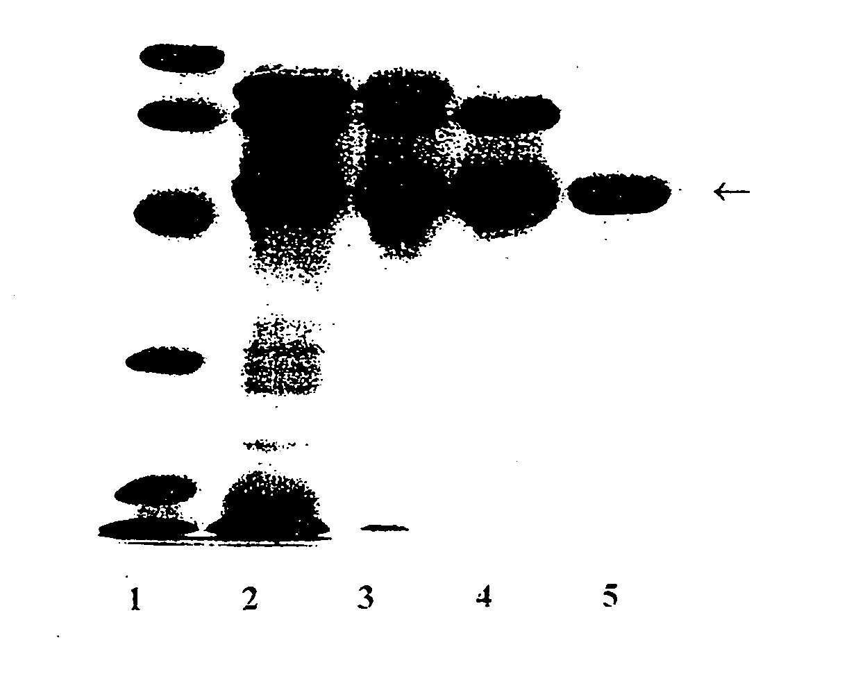 Method For Improving Insulin Sensitivity By Administering an Inhibitor of Antitrypsin