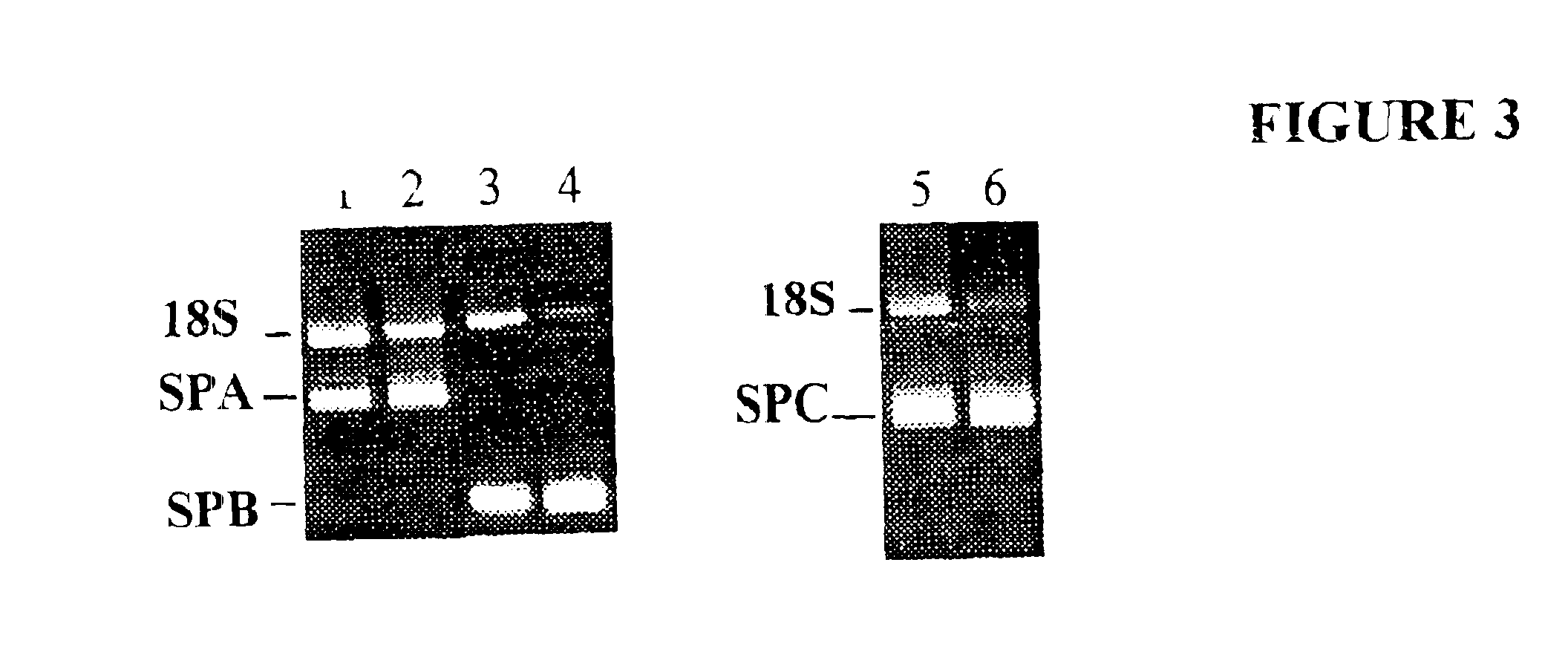 Method for treating respiratory distress syndrome
