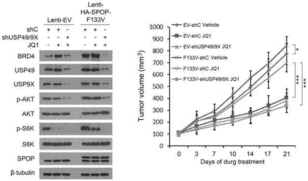 Prostatic cancer marker SPOP and application thereof in guiding of tumor treatment