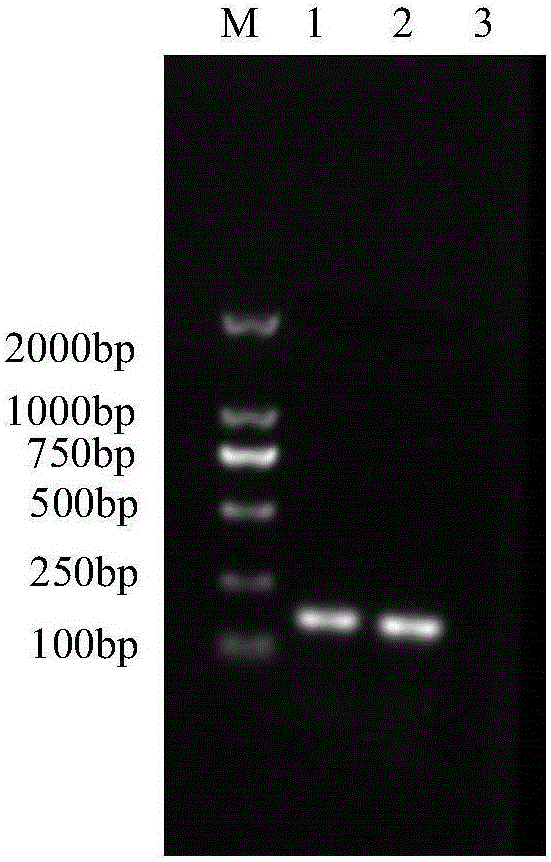 Fluorescent PCR (polymerase chain reaction) detection kit for babesia caballi disease