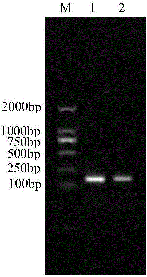 Fluorescent PCR (polymerase chain reaction) detection kit for babesia caballi disease