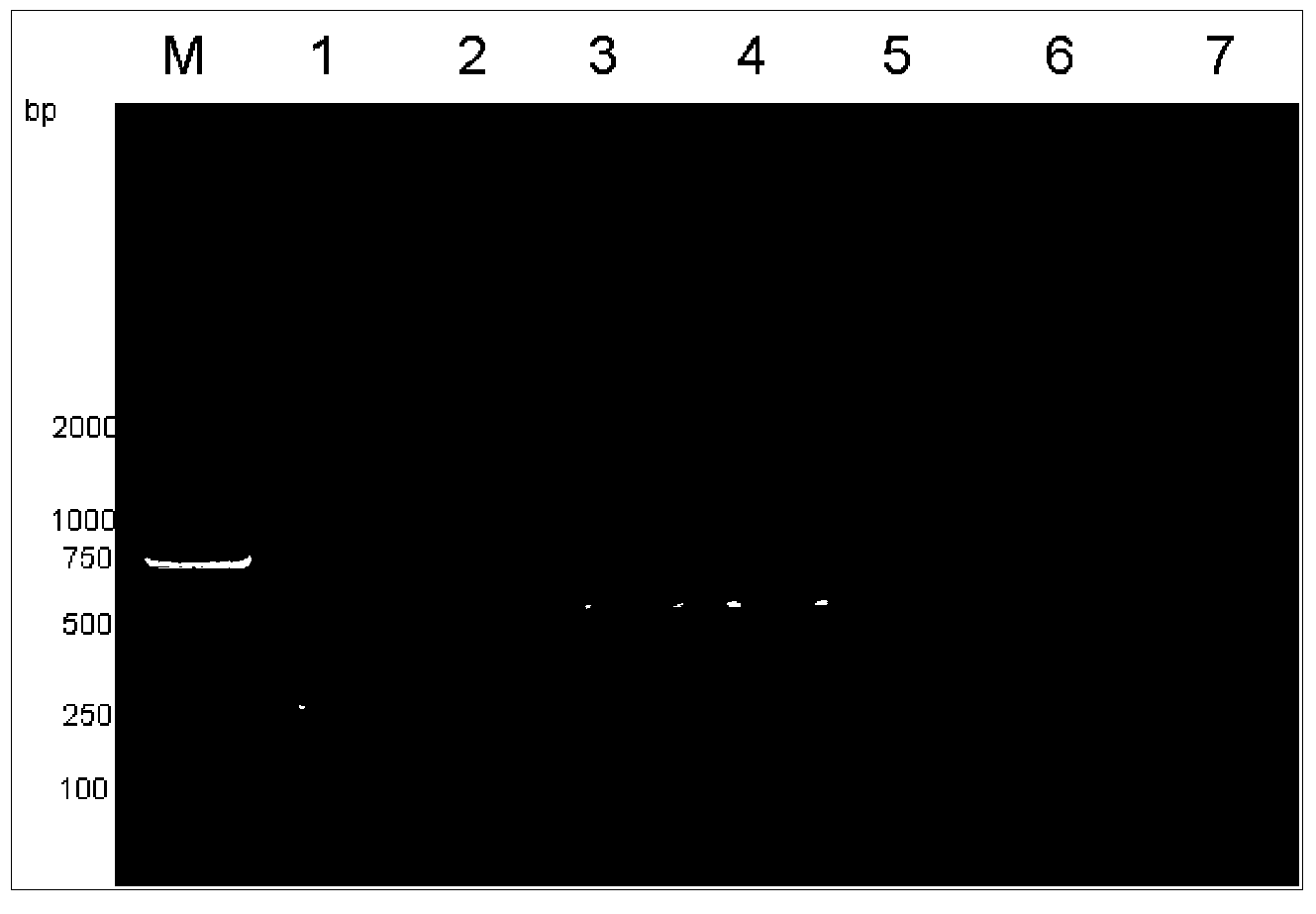 Kit for identifying nucleic acid of mycobacterium pathogeny through multiple PCR (polymerase chain reaction)