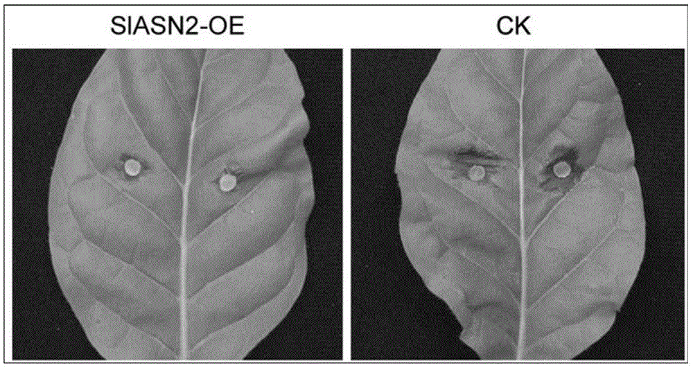 Plant disease-resistance regulating gene SlASN2 and application thereof