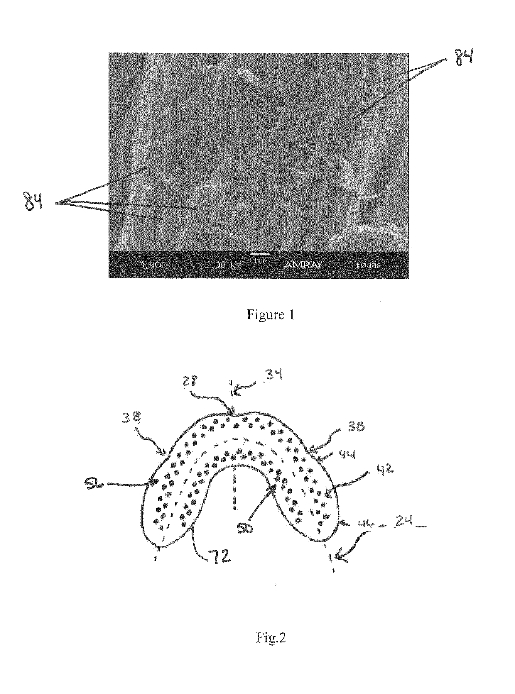 Custom-Formable Night Grinding Appliance and Method of Use