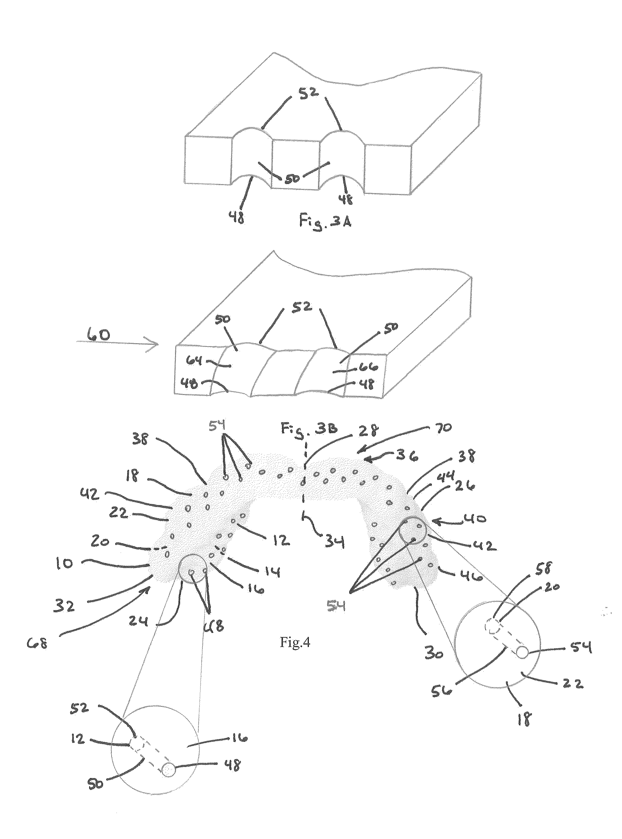 Custom-Formable Night Grinding Appliance and Method of Use