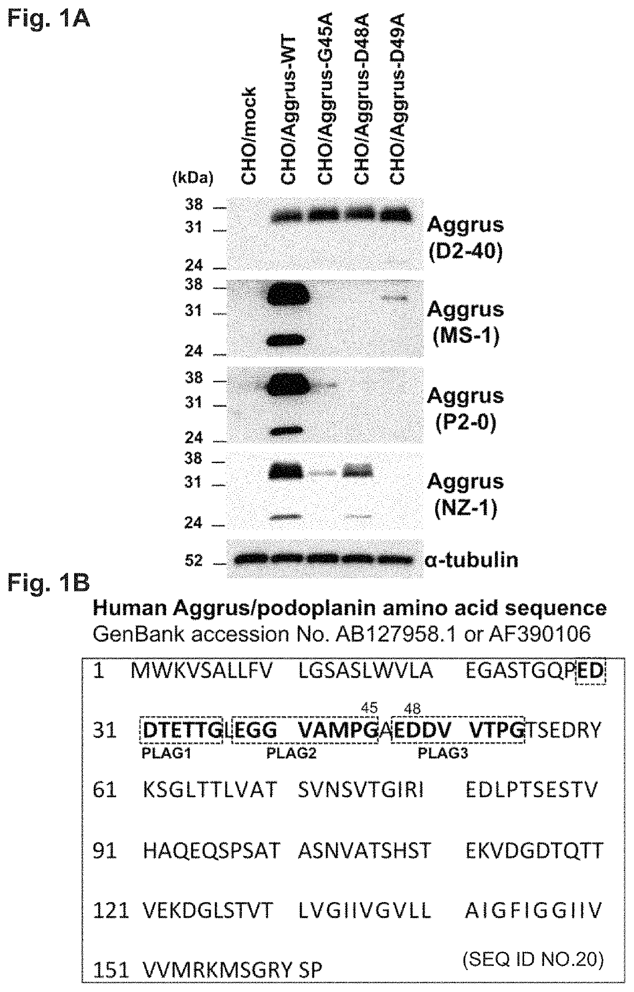 Anti-Aggrus monoclonal antibody, domain in Aggrus which is required for binding to CLEC-2, and method for screening for Aggrus-CLEC-2 binding inhibitor