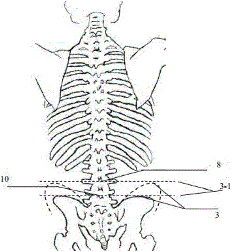 Positioning method for spine lumbar vertebra gap