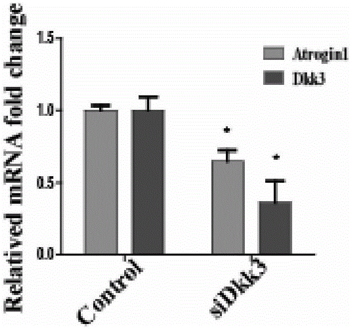 Application and related medicines of DKK3 gene