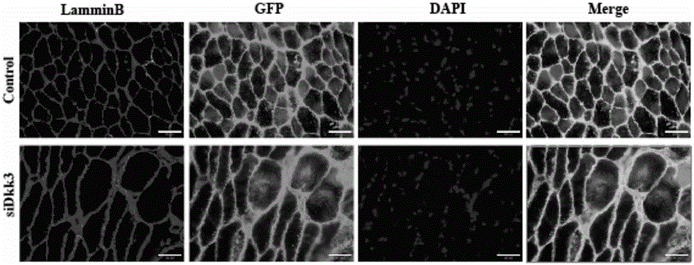 Application and related medicines of DKK3 gene